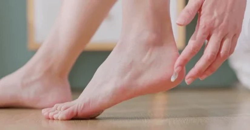 5 Unique Cures for Cracked Heels This Winter—Amazing Results!